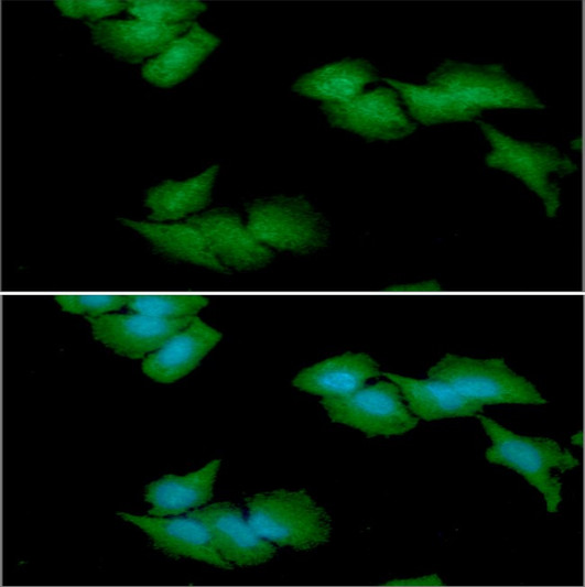 ICC IF of human CBR3 in HeLa cells with Alexa Fluor 488 and DAPI staining